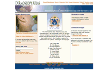Tablet Screenshot of dermoscopyatlas.com